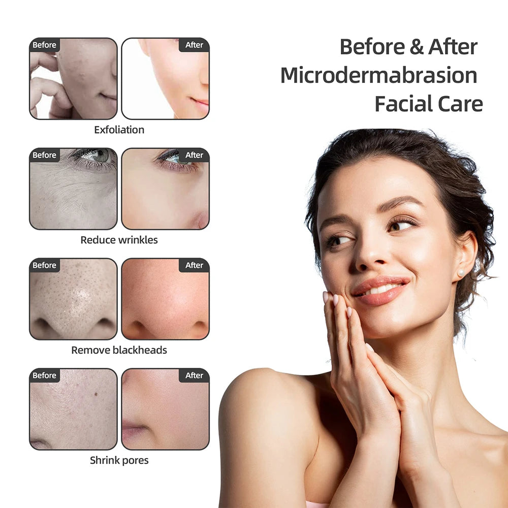Foreverlily Diamond Microdermabrasion Machine Water Spray For Skin Care