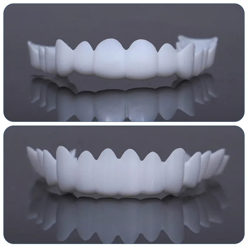 Dental Snap On Veneers