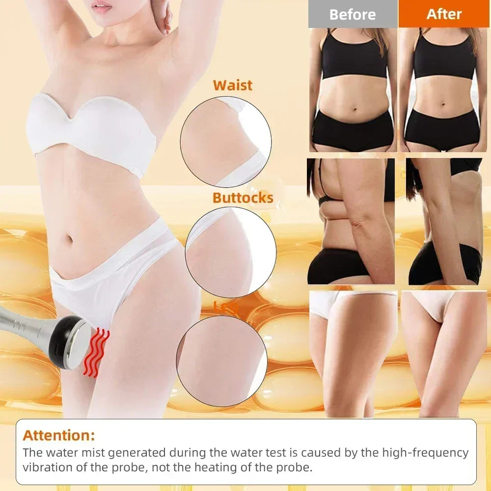 Missheart 4 In 1 Cavitation Ultrasonic Beauty Machine For Body